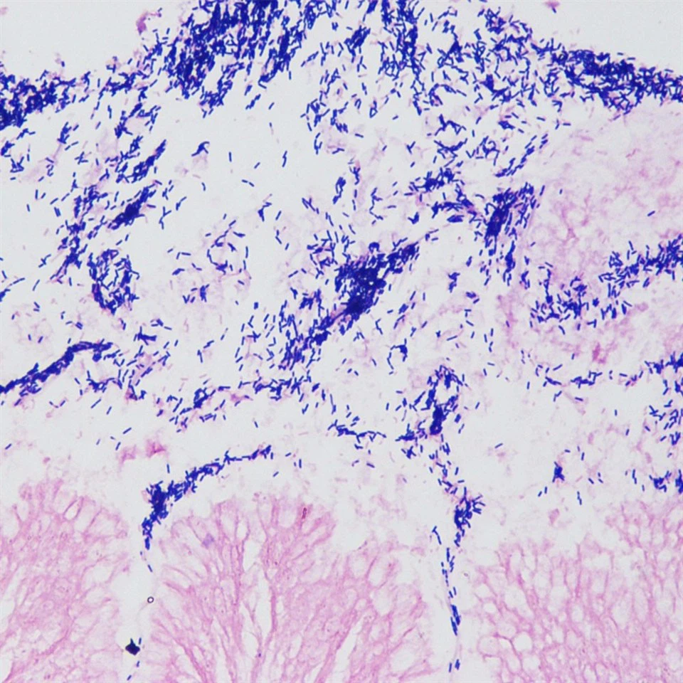 255334e1cc703f88637a2eef894909d8