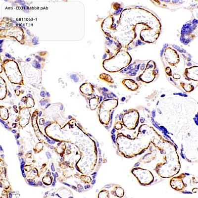 PAB Kelinci Anti-CD31