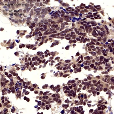 PAB Kelinci Anti-P38