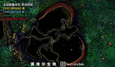 Eluen Antibodi Imunostaining