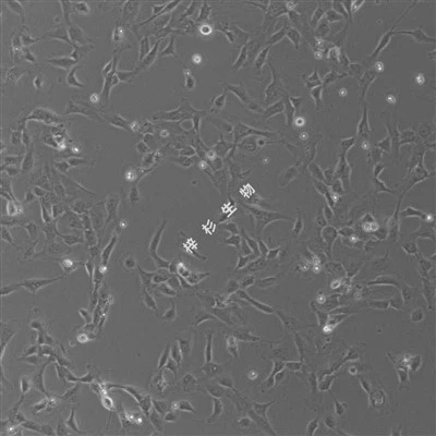 Kit Media Kultur Sel Endotel Vena Umbilikal Manusia yang Ditransfusikan SV40T (PUMC-HUVEC-T1)